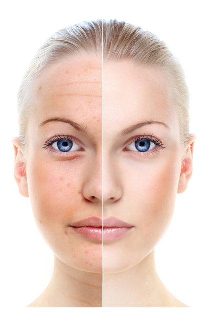 Why skin ages - image